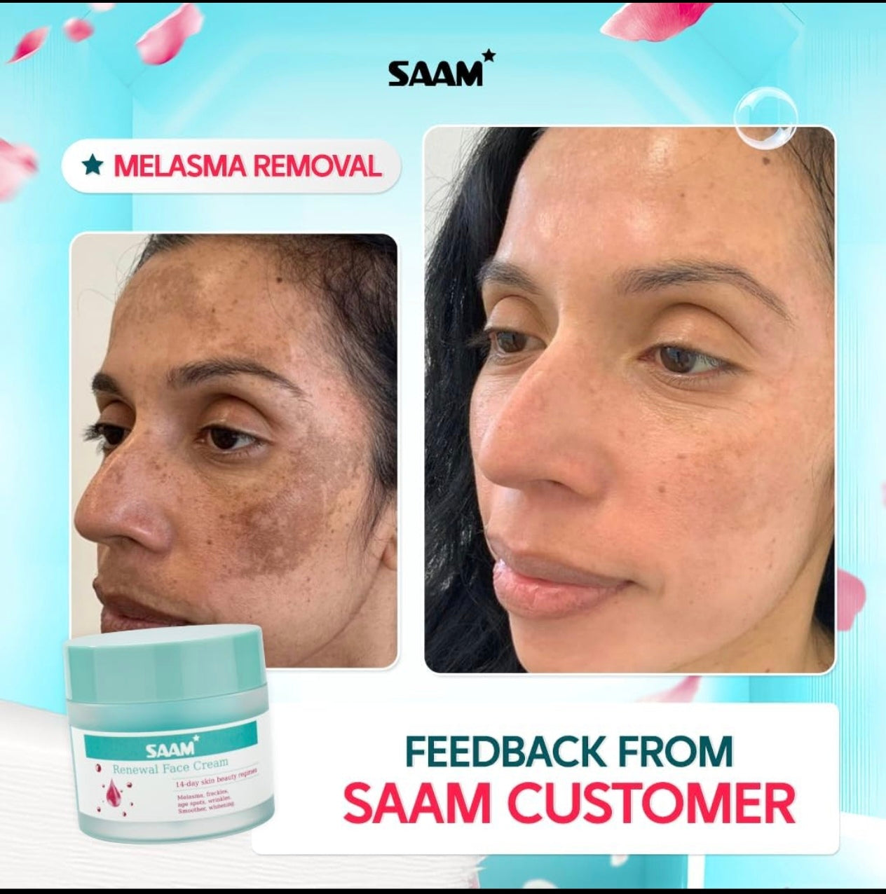 SAAM Renewal Face Cream - 14-Day Skin Beauty Regimen for Glowing & Spotless Skin